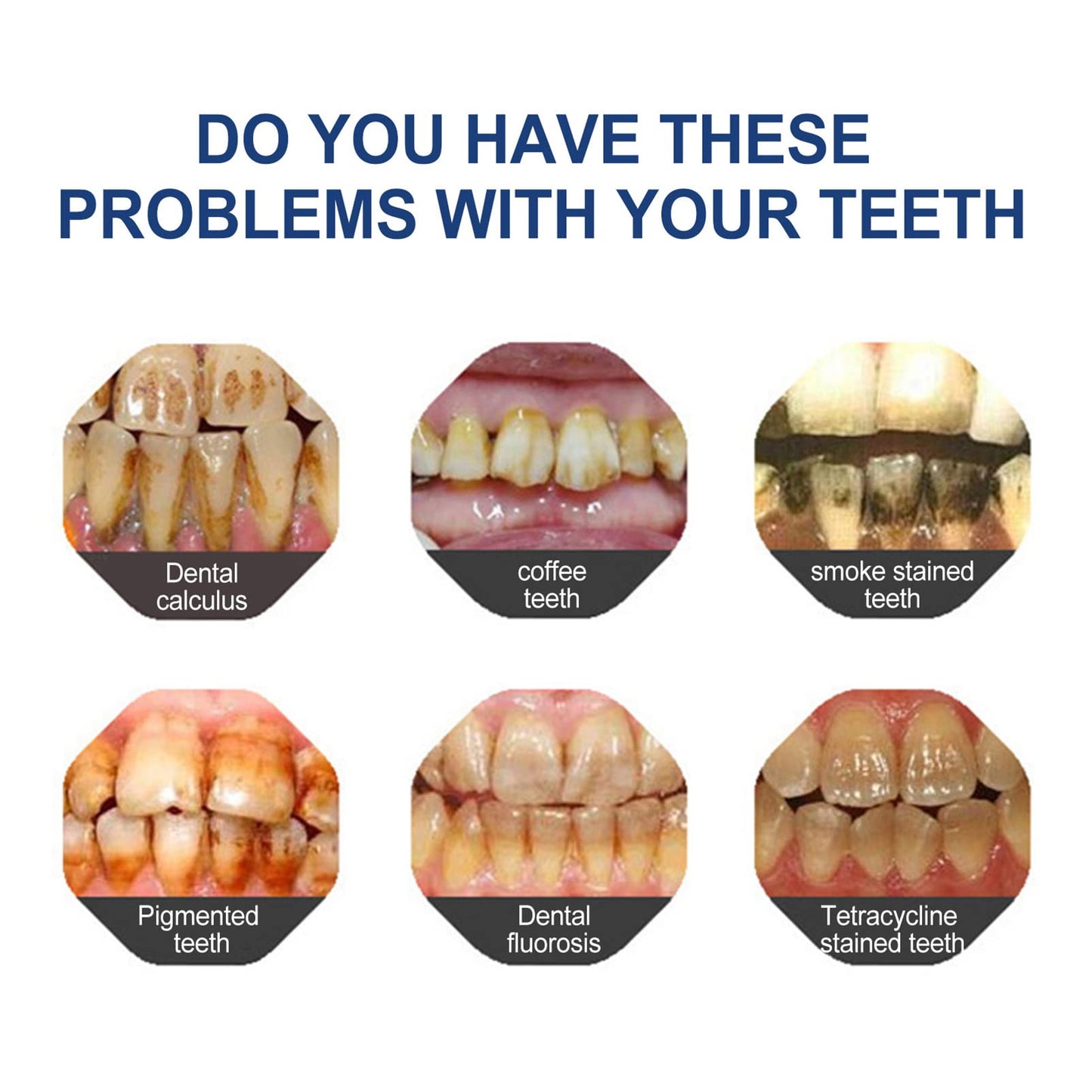 ✨Ends Tonight: Get 50% OFF Before It’s Gone!🎁 BBOJI™ Fluoride-Free Hydroxyapatite Toothpaste – Gentle Whitening & Enamel Strength for Sensitive Teeth